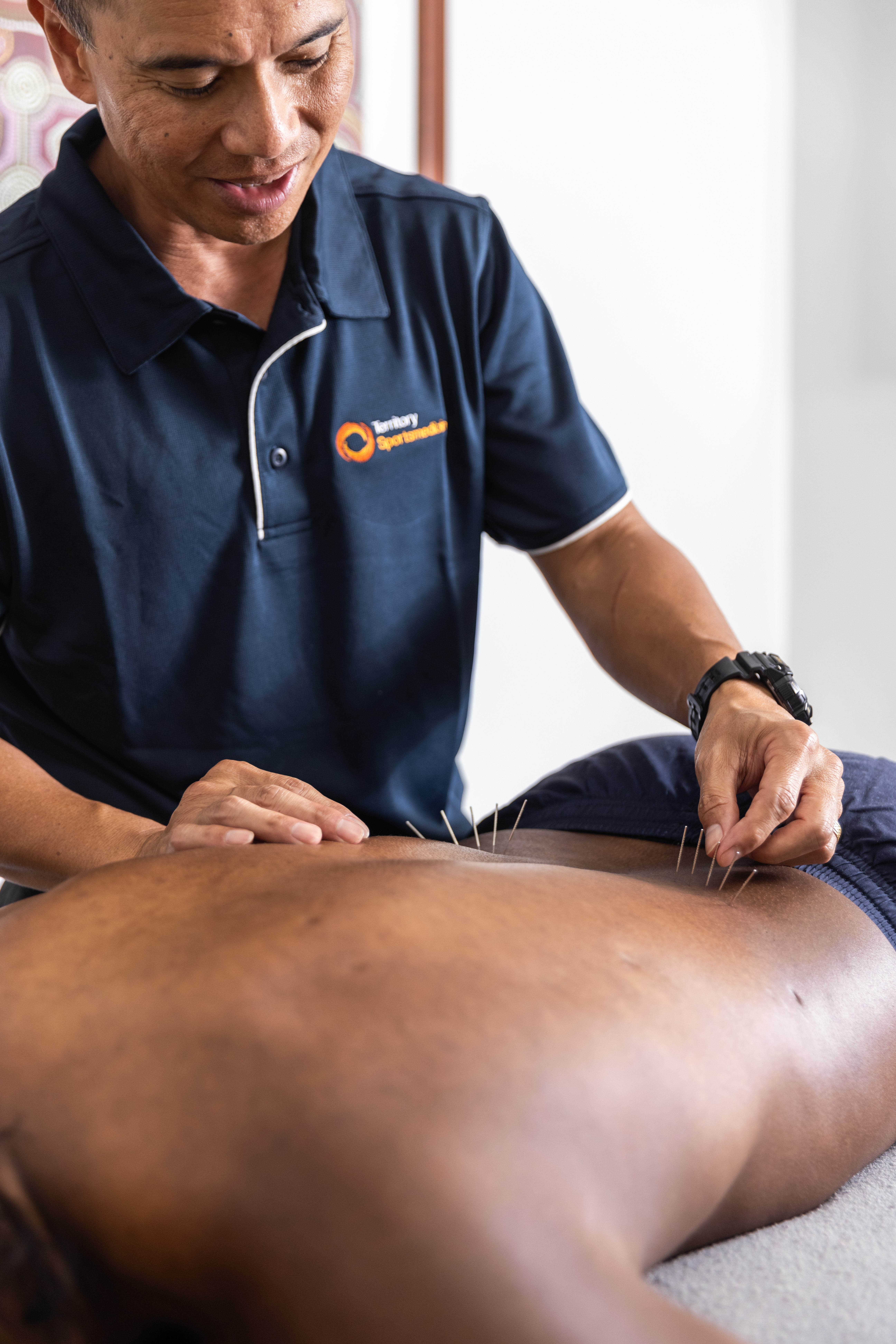 Dry Needling & Acupuncture